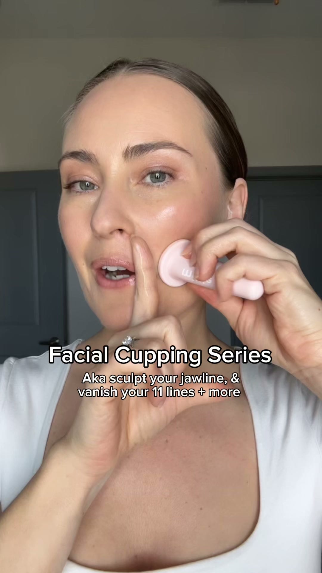 Facial Cupping Set Video